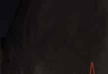 응급상황 대처법 a man sitting on a skateboard in front of a wall